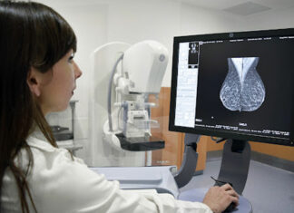 Tardía detección del cáncer de mama en Tehuacán