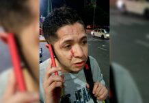 Agreden a joven en besotón de Six Flags México COPRED condenó las “agresiones homofóbicas” durante el besotón que se realizó la tarde del jueves afuera de Six Flags.