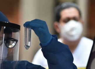 Baja el Covid-19 en Puebla; hay 465 casos en 1 día El secretario de Salud informó que actualmente hay 3 mil 023 casos activos de Covid-19, distribuidos en 80 municipios. Foto: Es Imagen