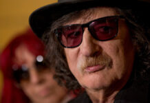 Hospitalizan a Charly García por quemadura en la pierna Charly García presentó complicaciones clínicas propias del caso, la cuales afortunadamente ha ido superando.. Foto: Especial