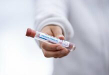 México contabiliza 5910 casos de Covid en un día Covid-19