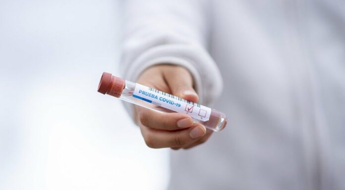 México contabiliza 5910 casos de Covid en un día Covid-19