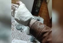 Le ponen yeso en el IMSS y no se puede quitar su chamarra Yeso
