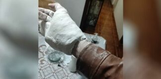 Le ponen yeso en el IMSS y no se puede quitar su chamarra Yeso