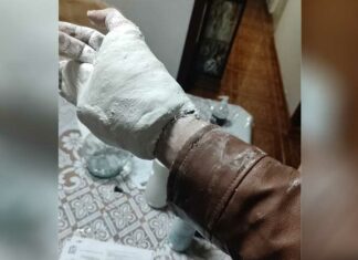 Le ponen yeso en el IMSS y no se puede quitar su chamarra Yeso