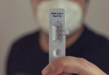 México suma 749 nuevos casos de Covid-19 24 horas Covid-19