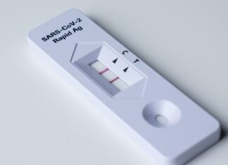 Casos Covid podrían aumentar en temporada invernal, alerta Salud Covid-19