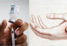 EU alista vacunas para enfrentar Viruela del Mono viruela vacunas