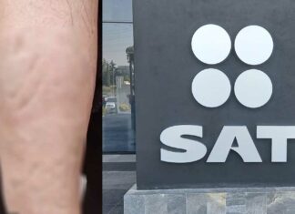 Mujer sufre ataque con ácido afuera del SAT de Atlixcáyotl Mujer