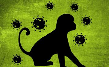 Confirman 21 casos de Viruela del Mono en Nigeria Viruela del mono