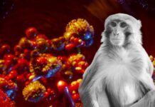 Argentina confirma primer caso de viruela del mono Argentina