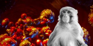 Argentina confirma primer caso de viruela del mono Argentina