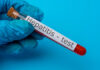 Argentina detecta primer caso de hepatitis infantil aguda en LATAM hepatitis