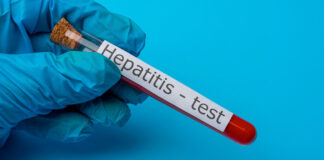 Argentina detecta primer caso de hepatitis infantil aguda en LATAM hepatitis