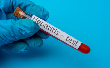 Argentina detecta primer caso de hepatitis infantil aguda en LATAM hepatitis