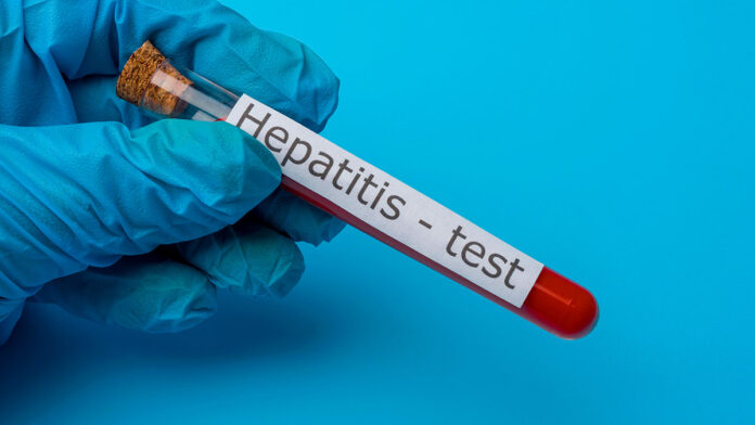 hepatitis hepatitis