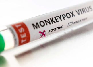 Casos actuales de viruela del mono serían la punta del iceberg: OMS casos