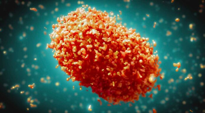 Suman 12 casos de viruela símica en Puebla viruela