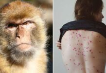 Brasil reporta su primera muerte por viruela símica Es "posible” que las personas infectadas puedan transmitir el virus de la viruela del mono a los animales a través del contacto cercano