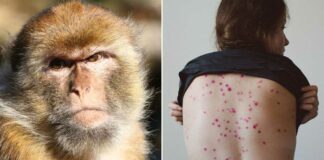 Mascotas pueden contraer viruela del mono: CDC Es "posible” que las personas infectadas puedan transmitir el virus de la viruela del mono a los animales a través del contacto cercano