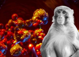 San Francisco entra en estado de emergencia por viruela del mono San