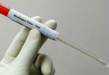 Viruela del mono alcanza 26 mil casos mundiales Viruela