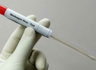 Viruela del mono alcanza 26 mil casos mundiales Viruela
