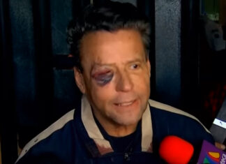 Alfredo Adame tiene 4 fracturas en el cráneo tras golpiza Alfredo-Adame