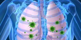 Argentina reporta tercera muerte por Neumonía Atípica argentina