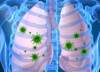 Argentina reporta tercera muerte por Neumonía Atípica argentina