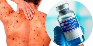 Vacuna contra viruela símica es efectiva, reporta EU vacuna