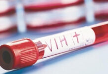 Salud realizará jornadas de detección de VIH en Puebla Salud