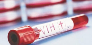 Salud realizará jornadas de detección de VIH en Puebla Salud