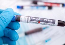 OMS declara “listos” los ensayos de vacunas contra virus de Marburgo OMS