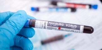 OMS declara “listos” los ensayos de vacunas contra virus de Marburgo OMS