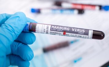 OMS declara “listos” los ensayos de vacunas contra virus de Marburgo OMS