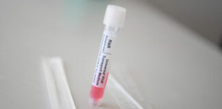 Covid contagia a 223 poblanos en puente de Semana Santa Covid