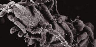 Suman 15 muertos por brote de cólera en Sudáfrica ´cólera