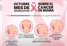 Salud busca reducir mortalidad por cáncer de mama en Puebla Salud