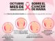 Salud busca reducir mortalidad por cáncer de mama en Puebla Salud