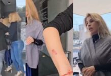 “Lady mordidas” agrede a empleada de salón de uñas para no pagar Mordida