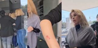 “Lady mordidas” agrede a empleada de salón de uñas para no pagar Mordida