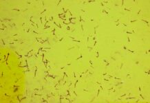 Salud descarta defunciones por dengue en las últimas 24 horas Salud