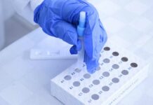 Registra Puebla 33 casos activos de Covid-19: Salud casos
