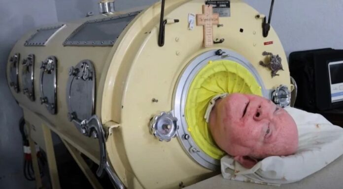 Fallece Paul Alexander, el hombre que vivió en un pulmón de acero Paul