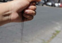 Salud atiende a 15 personas más con síntomas de rinitis por ceniza Salud
