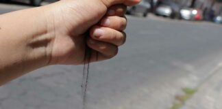 Salud atiende a 15 personas más con síntomas de rinitis por ceniza Salud