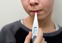 Puebla sin casos confirmados de Sarampión: Salud Sarampión