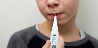 Puebla sin casos confirmados de Sarampión: Salud Sarampión