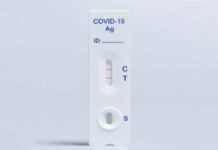 Registra Puebla 17 casos activos de Covid-19: Salud Casos